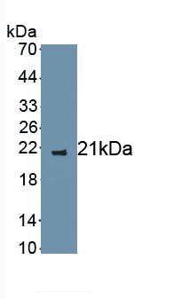 1 - Polyclonal Antibody to Interleukin 2 (IL2) AP74548