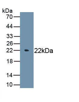 1 - Polyclonal Antibody to Interleukin 6 (IL6) AP74553