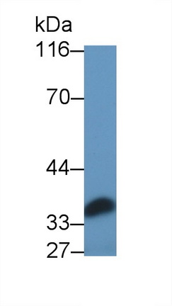 1 - Polyclonal Antibody to Interleukin 6 (IL6) AP74660