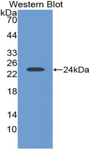 1 - Polyclonal Antibody to Leukemia Inhibitory Factor (LIF) AP74554