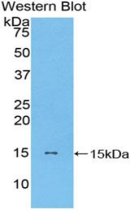 1 - Polyclonal Antibody to Monocyte Chemotactic Protein 1 (MCP1) AP74685