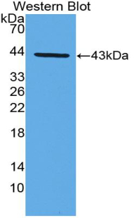 1 - Polyclonal Antibody to Macrophage Derived Chemokine (MDC) AP74555