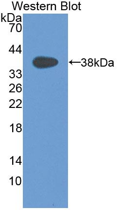 1 - Polyclonal Antibody to Macrophage Inflammatory Protein 1 Alpha (MIP1a) AP74556