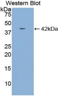 1 - Polyclonal Antibody to Macrophage Inflammatory Protein 1 Beta (MIP1b) AP74558