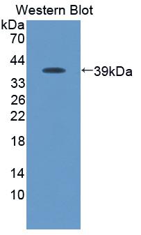1 - Polyclonal Antibody to Macrophage Inflammatory Protein 3 Beta (MIP3b) AP74561