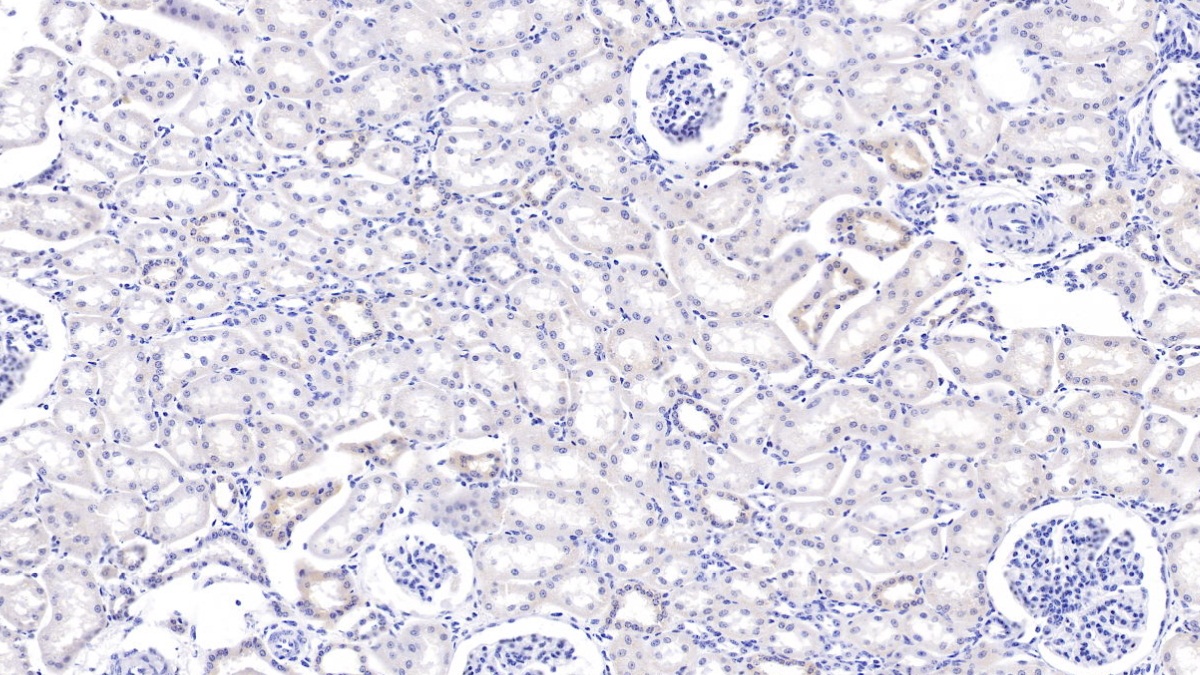 2 - Polyclonal Antibody to Matrix Metalloproteinase 7 (MMP7) AP74795