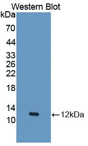 1 - Polyclonal Antibody to Regulated On Activation In Normal T-Cell Expressed And Secreted (RANTES) AP74744