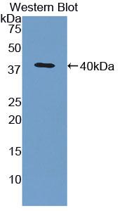 1 - Polyclonal Antibody to Regulated On Activation In Normal T-Cell Expressed And Secreted (RANTES) AP74507