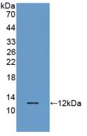 1 - Polyclonal Antibody to Regulated On Activation In Normal T-Cell Expressed And Secreted (RANTES) AP74508