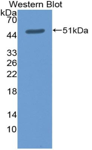 1 - Polyclonal Antibody to Cluster Of Differentiation 30 Ligand (CD30L) AP74721