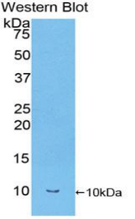 1 - Polyclonal Antibody to Transforming Growth Factor Alpha (TGFa) AP74565