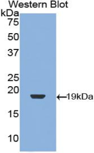 1 - Polyclonal Antibody to Transforming Growth Factor Beta 1 (TGFb1) AP74487