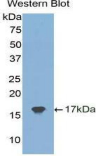 1 - Polyclonal Antibody to Tissue Inhibitors Of Metalloproteinase 2 (TIMP2) AP74566