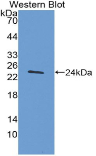 1 - Polyclonal Antibody to Tissue Inhibitors Of Metalloproteinase 4 (TIMP4) AP74567
