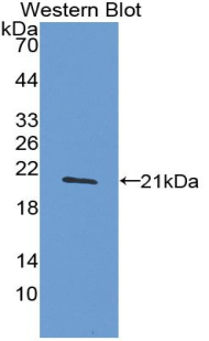1 - Polyclonal Antibody to Tumor Necrosis Factor Alpha (TNFa) AP74509
