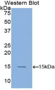 1 - Polyclonal Antibody to Tumor Necrosis Factor Beta (TNFb) AP74568