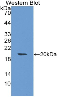 1 - Polyclonal Antibody to Tumor Necrosis Factor Beta (TNFb) AP74570