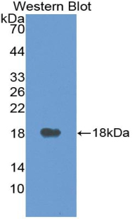 1 - Polyclonal Antibody to Vascular Endothelial Growth Factor A (VEGFA) AP74719
