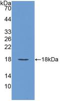 1 - Polyclonal Antibody to Vascular Endothelial Growth Factor A (VEGFA) AP74510