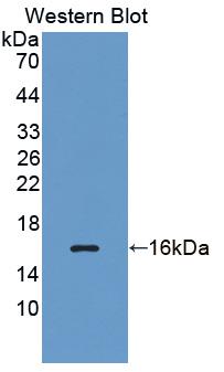 1 - Polyclonal Antibody to Vascular Endothelial Growth Factor C (VEGFC) AP74571