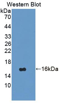 1 - Polyclonal Antibody to Vascular Endothelial Growth Factor C (VEGFC) AP74751