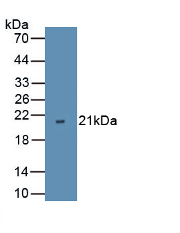 1 - Polyclonal Antibody to Vascular Endothelial Growth Factor D (VEGFD) AP74486