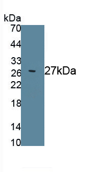 1 - Polyclonal Antibody to Prostate Specific Antigen (PSA) AP74492