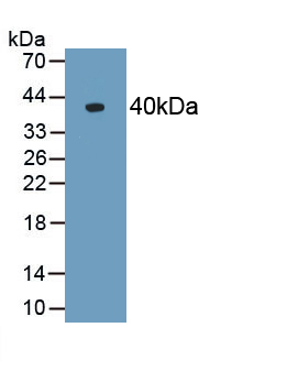 1 - Polyclonal Antibody to Alpha-2-Heremans Schmid Glycoprotein (AHSG) AP74493