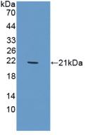 1 - Polyclonal Antibody to Triggering Receptor Expressed On Myeloid Cells 1 (TREM1) AP74572