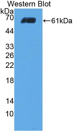 1 - Polyclonal Antibody to Collagen Type I Alpha 2 (COL1a2) AP74573
