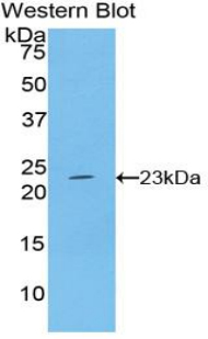 1 - Polyclonal Antibody to Interferon Beta (IFNb) AP74684