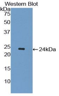 1 - Polyclonal Antibody to Interleukin 1 Receptor Antagonist (IL1RA) AP74575