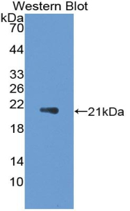 1 - Polyclonal Antibody to Interleukin 1 Receptor Antagonist (IL1RA) AP74576
