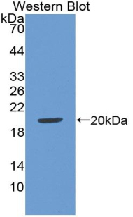 1 - Polyclonal Antibody to Atrial Natriuretic Peptide (ANP) AP74577