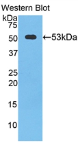 1 - Polyclonal Antibody to Cathepsin K (CTSK) AP74579