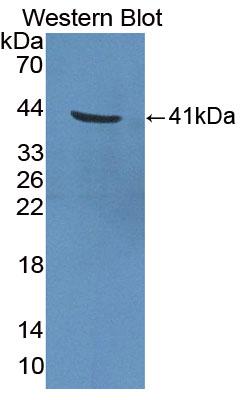 1 - Polyclonal Antibody to Galectin 4 (GAL4) AP74581