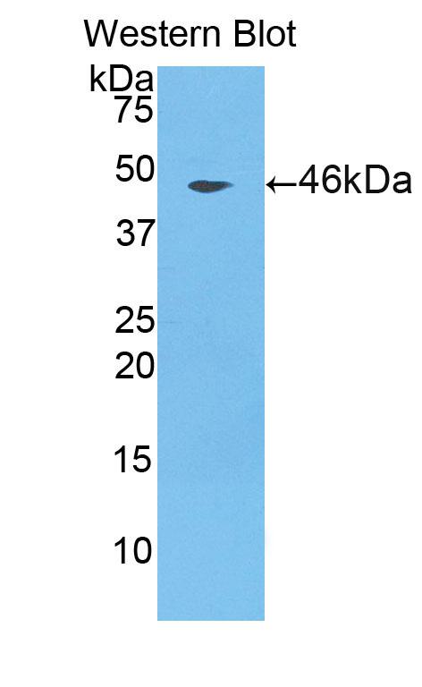 1 - Polyclonal Antibody to Cathepsin L (CTSL) AP74582
