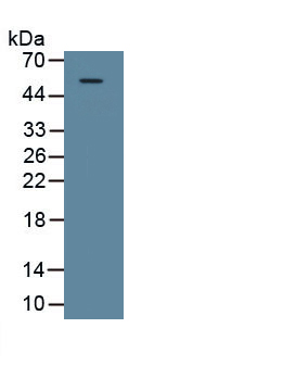 1 - Polyclonal Antibody to Galectin 9 (GAL9) AP74583