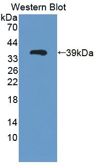 1 - Polyclonal Antibody to Galectin 12 (GAL12) AP74750