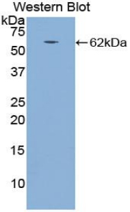 1 - Polyclonal Antibody to Cathepsin A (CTSA) AP74664
