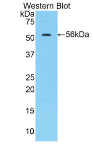 1 - Polyclonal Antibody to Cathepsin A (CTSA) AP74665