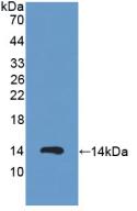 1 - Polyclonal Antibody to Protein Kinase Inhibitor Alpha (PKIa) AP74686