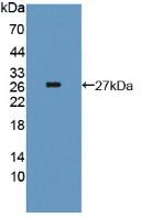 1 - Polyclonal Antibody to Thyroglobulin (TG) AP74481