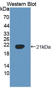 1 - Polyclonal Antibody to Vasoactive Intestinal Peptide (VIP) AP74585
