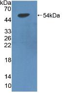 1 - Polyclonal Antibody to Lipoprotein lipase (LPL) AP74485