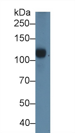 1 - Polyclonal Antibody to Complement Component 5a (C5a) AP74784