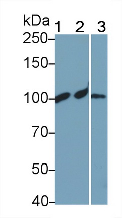 1 - Polyclonal Antibody to Complement Component 4a (C4a) AP74586