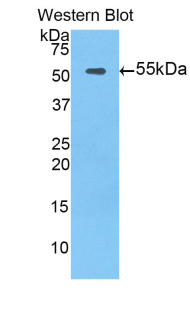 1 - Polyclonal Antibody to Tissue Factor Pathway Inhibitor (TFPI) AP74587