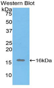 1 - Polyclonal Antibody to Inhibin Alpha (INHa) AP74626