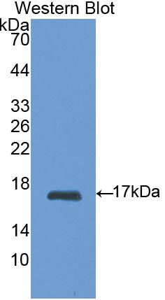 1 - Polyclonal Antibody to Retinol Binding Protein 1, Cellular (RBP1) AP74634